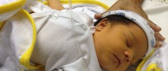 Пожелтение кожи на 3-4 день жизни - признак поражении вирусом у новорожденных