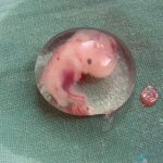 Syphilis can be the cause of early pregnancy termination.