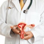 Причины возникновения и методы лечения полипа цервикального канала при беременности