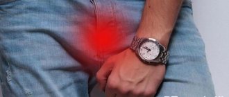 Signs of phimosis and methods of its treatment