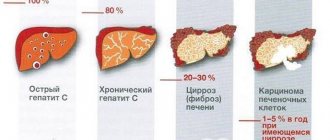 Признаки гепатита C