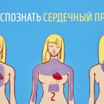 Signs of an upcoming heart attack