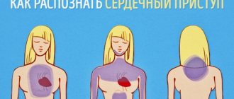 Признаки приближающегося сердечного приступа