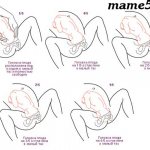 Процесс вставления головки ребенка в малый таз