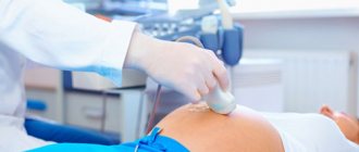 проведение допплерометрии