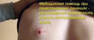 пулевое ранение в спину