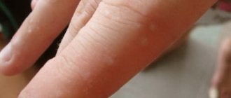 bubbles_on_fingers