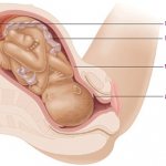 location of the cervix