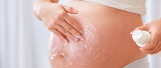 Stretch marks at 30 weeks