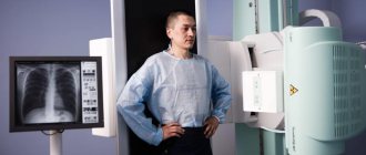 Рентген легких является одним из методов диагностики осумкованного плеврита