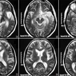 рентген мозга