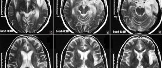 brain x-ray
