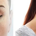 Риносинусит