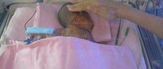 twins born at 33 weeks