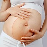 Роды при тазовом предлежании