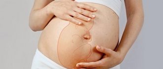 Роды при тазовом предлежании