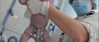 a newborn baby with a tied umbilical cord
