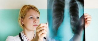 Pulmonary sarcoidosis – how to identify and treat the disease at all stages?