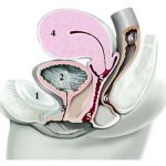 Схема расположения органов таза женщины в норме