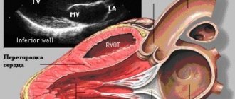 Heart ultrasound diagram