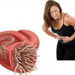 Симптомы гельминтоза при беременности — расстройство пищеварения и появление болей в области живота