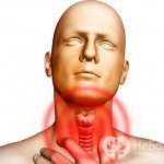 Симптомы вирусного фарингита обычно развиваются резко и проявляются на начальных этапах першением в горле