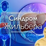 синдром Жильбера