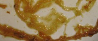 mucus in the stool of an adult
