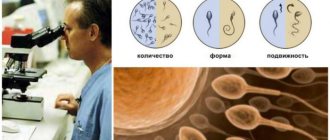 спермограмма и подготовка к ней