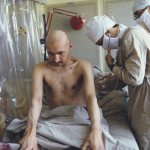 стационарное лечение лучевой болезни