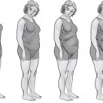 Стадии ожирения