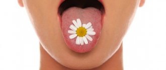 Stomatitis and its treatment