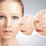 Сухая кожа при беременности: причины сухости