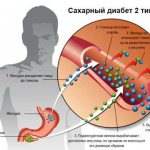 Суть проблемы