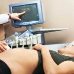 Free beta subunits of hCG in the 1st trimester