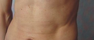 твердый живот у мужчин