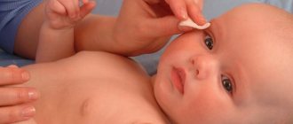 уход за глазами новорожденного