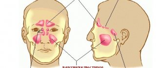 Thickening of the mucous membrane of the maxillary sinuses, cells of the ethmoid labyrinth. What is this treatment?