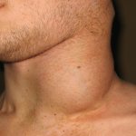 Увлечение узлов