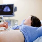 pregnancy ultrasound