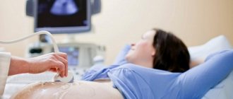 pregnancy ultrasound