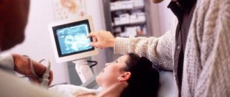 Ultrasound at 33 weeks of pregnancy