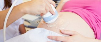 ultrasound