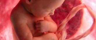 WMD during pregnancy by week - table, description!