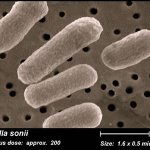 возбудители дизентерии