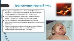 Врожденный сифилис: симптомы, клинические рекомендации