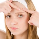 Выдавливание прыща