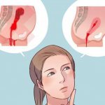 выделения после родов сколько идут виды норма