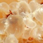 выделения_при_пузырном_заносе