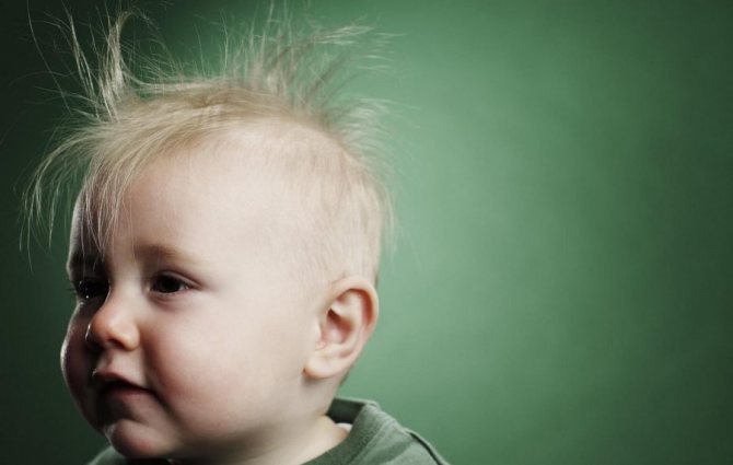 Выпадение волос - симптомы сифилиса у детей